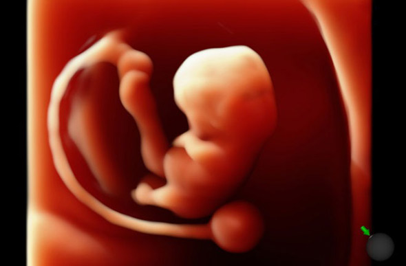 3d-ultrasound-1-