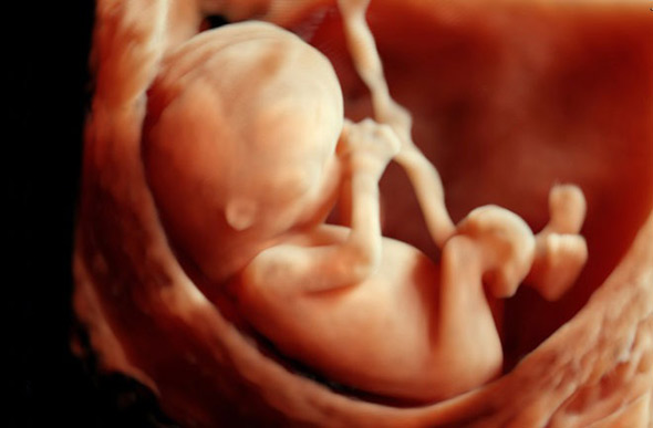 3d-ultrasound-2-