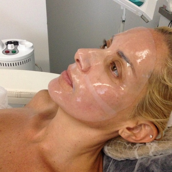 orthobotox3