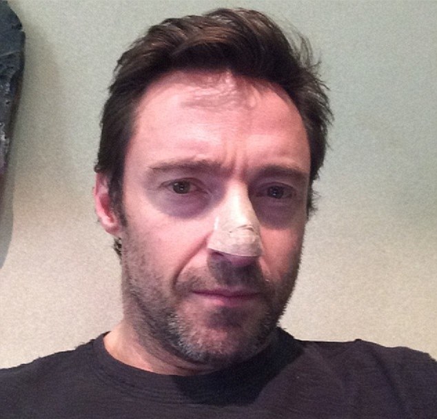 hughjackman