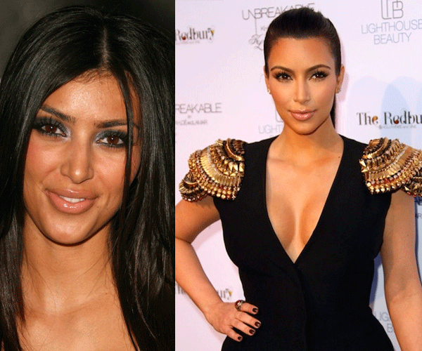 kim1