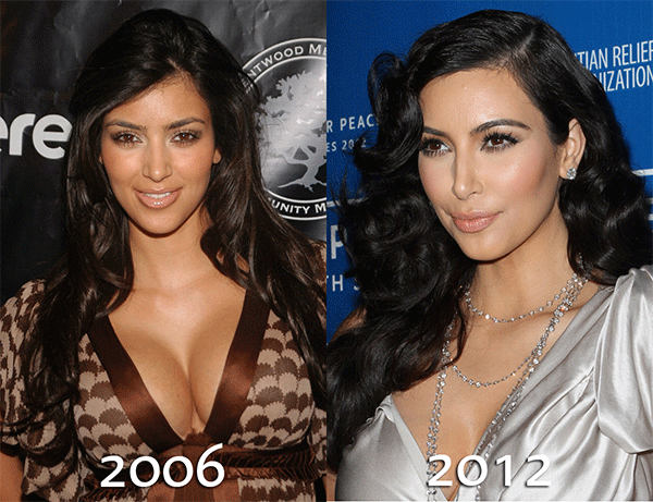 kim4